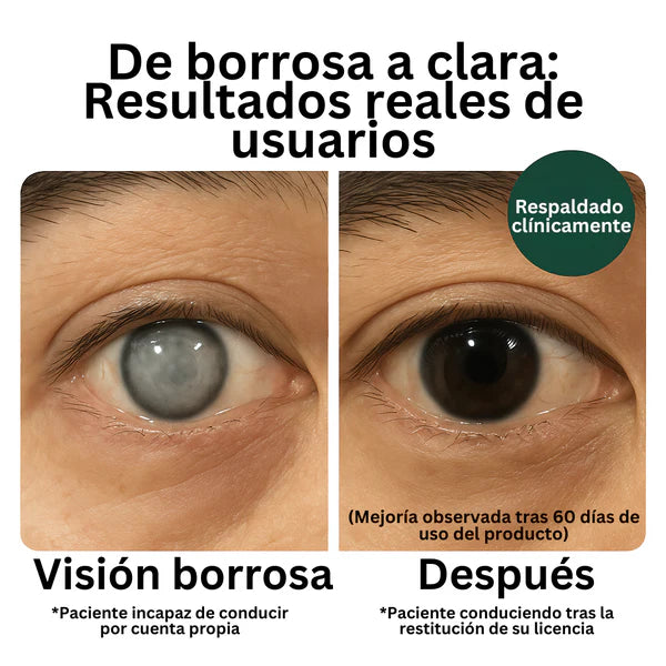 Zoone™ Luteína Vitaminas para los Ojos (Ebook + Gotas hidratantes vista)