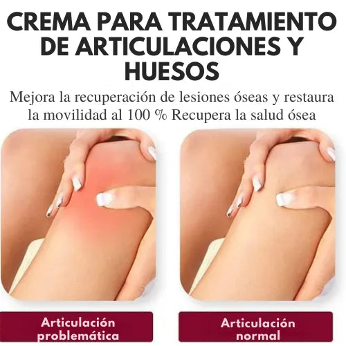 PerfectX™ Terapia Articular y Muscular (Paga 1, lleva 2 + Ebook)